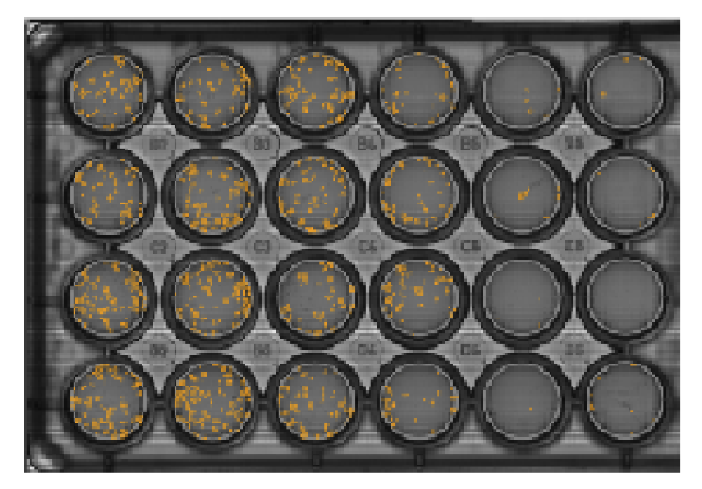 Omni live-cell imaging analysis showing automated colony detection and overlay in a clonogenic assay well