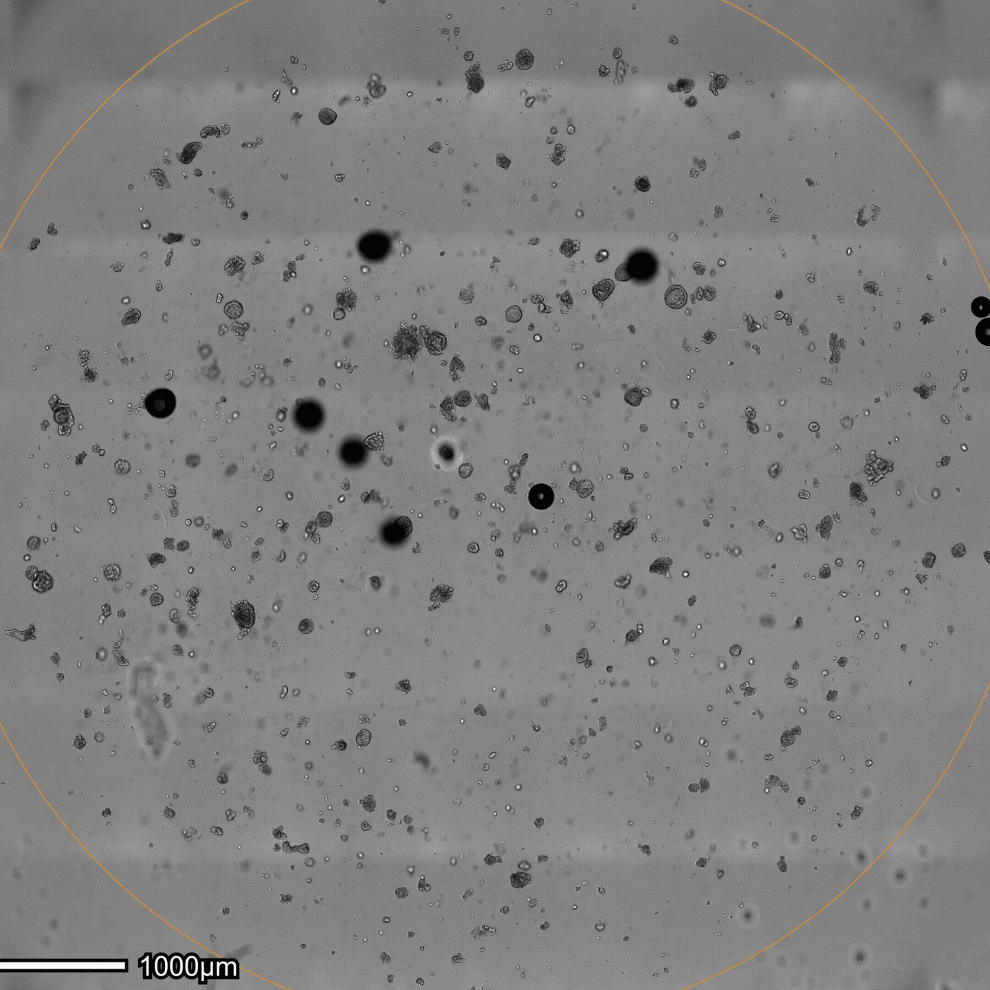 Hepatic organoid detection