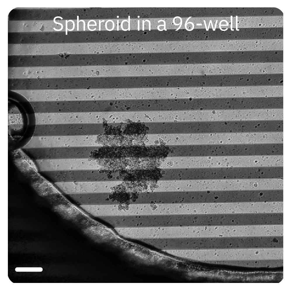 Cancer spheroid in a CytoView-Z 96-well plate for label-free impedance monitoring of tumor growth and immune cell killin