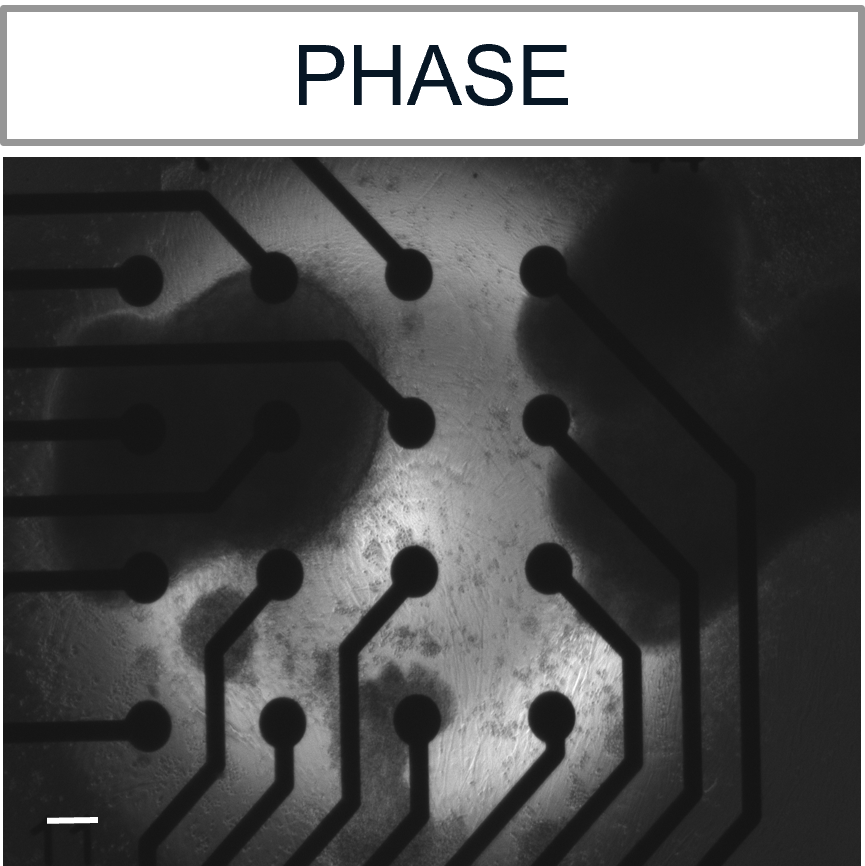 Channel rhodopsin (ChR2) expressing motor neurons were cocultured with skeletal myotubes on Maestro MEA plate