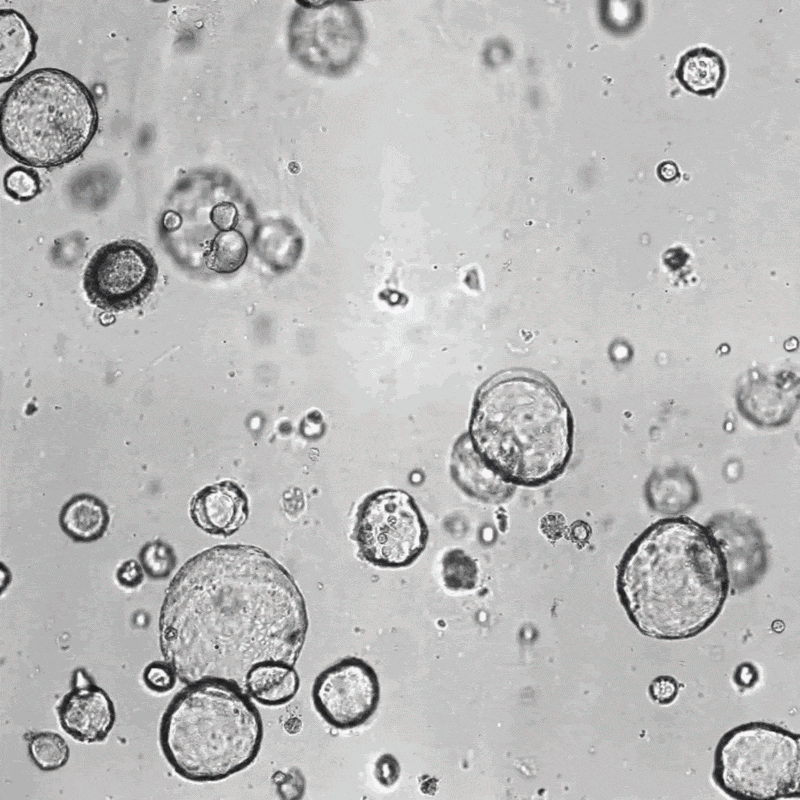 Organoid Counting with Omni