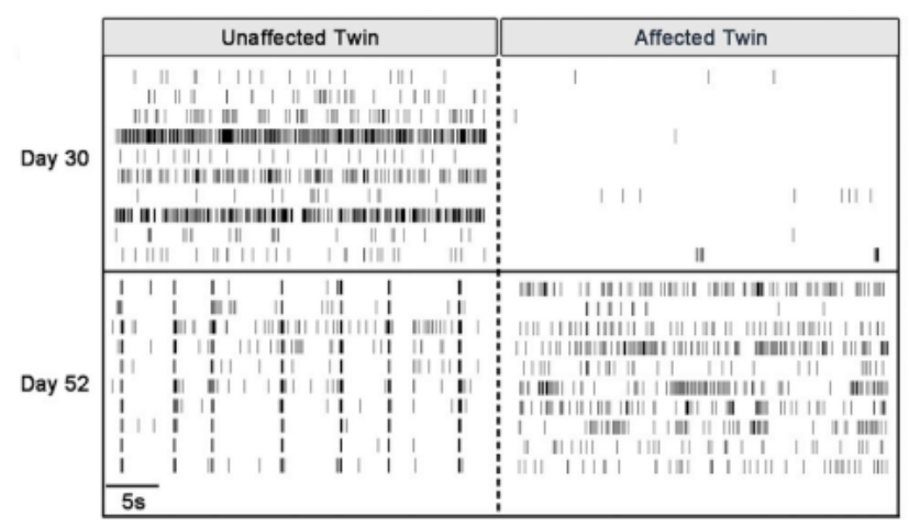 MEA raster plot comparing spontaneous neural activity in iPSC-derived dopaminergic neurons from Parkinson’s disease affected and unaffected twins