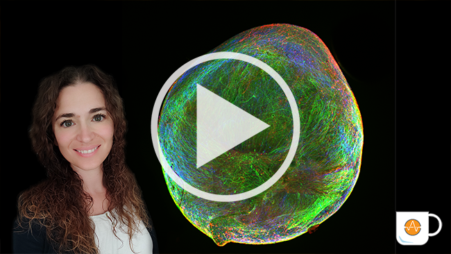 Neural Organoids Customer Story