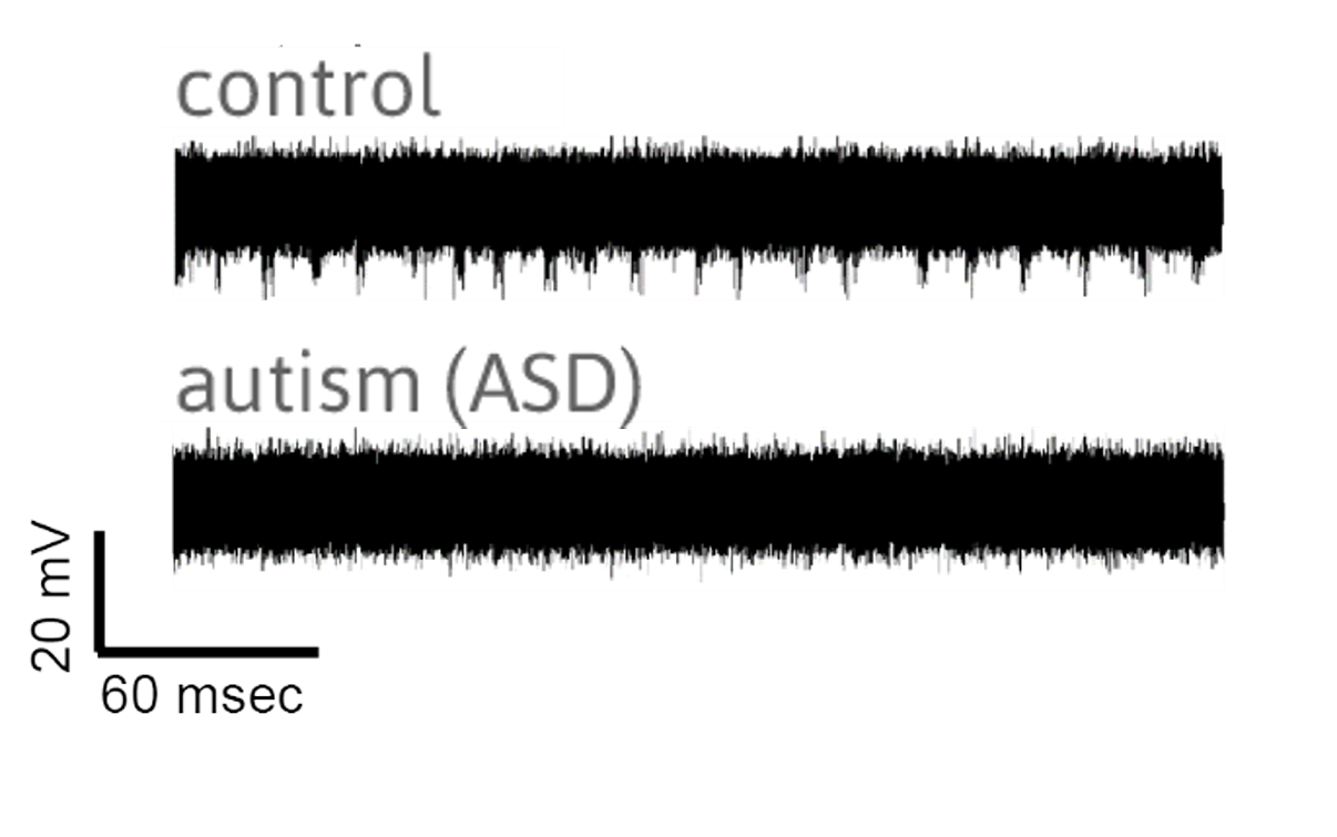 MEA electrophysiology traces comparing neural activity in control and autism spectrum disorder iPSC-derived cortical neuron models