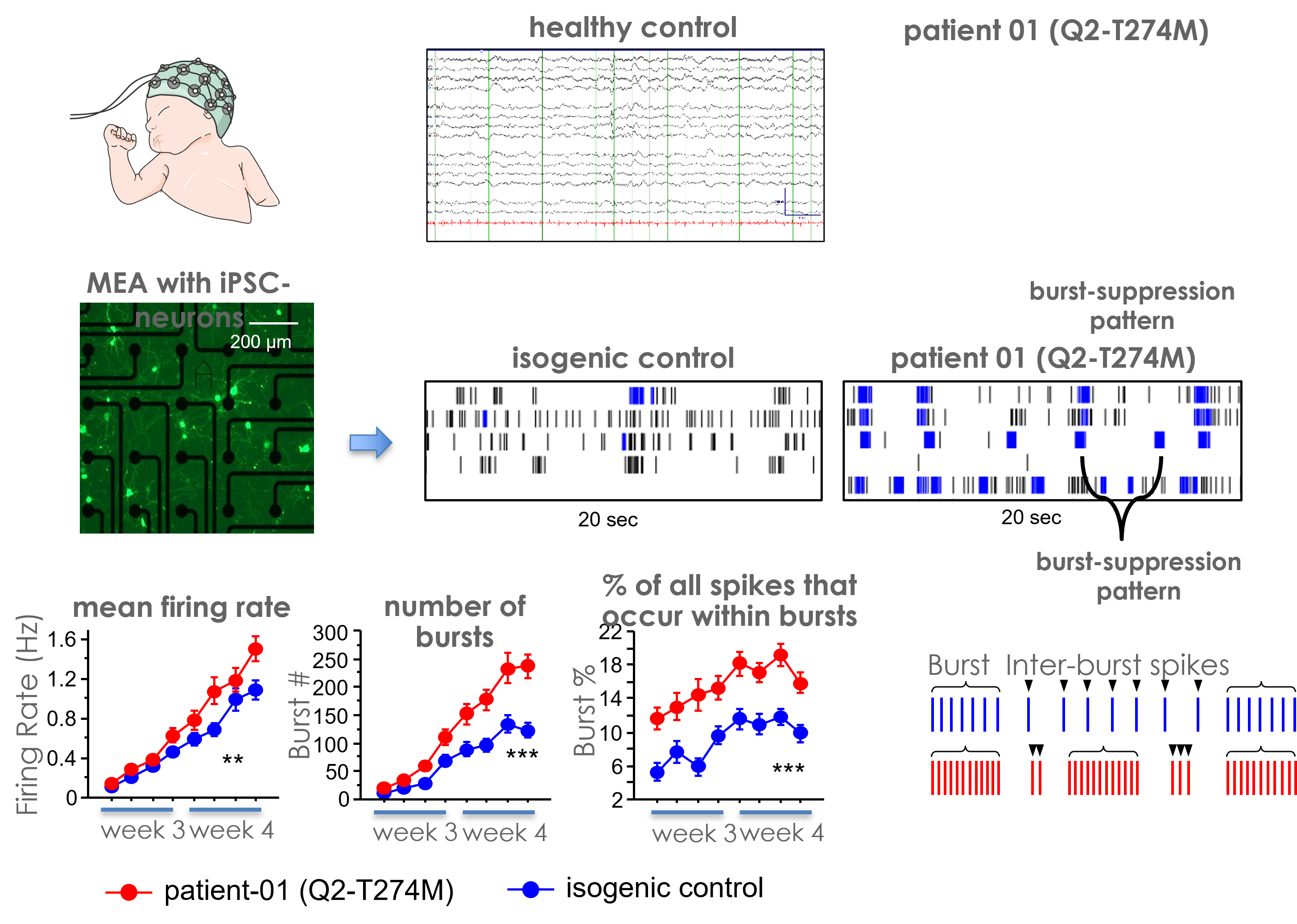 MEA electrophysiology data from iPSC-derived pediatric epilepsy models showing burst-suppression activity and neuronal firing patterns