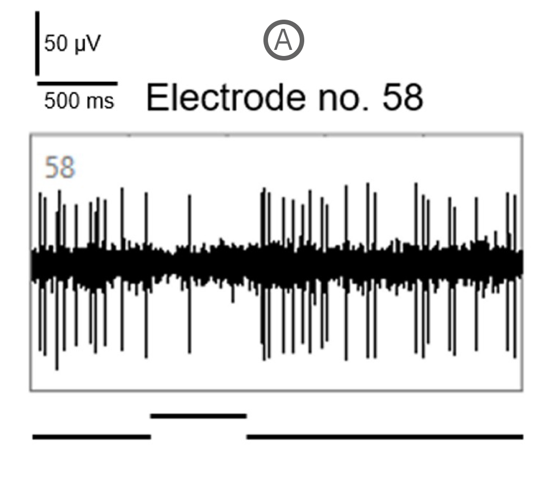 MEA electrophysiology recording showing spike activity from retinal ganglion cells on microelectrodes in vitro