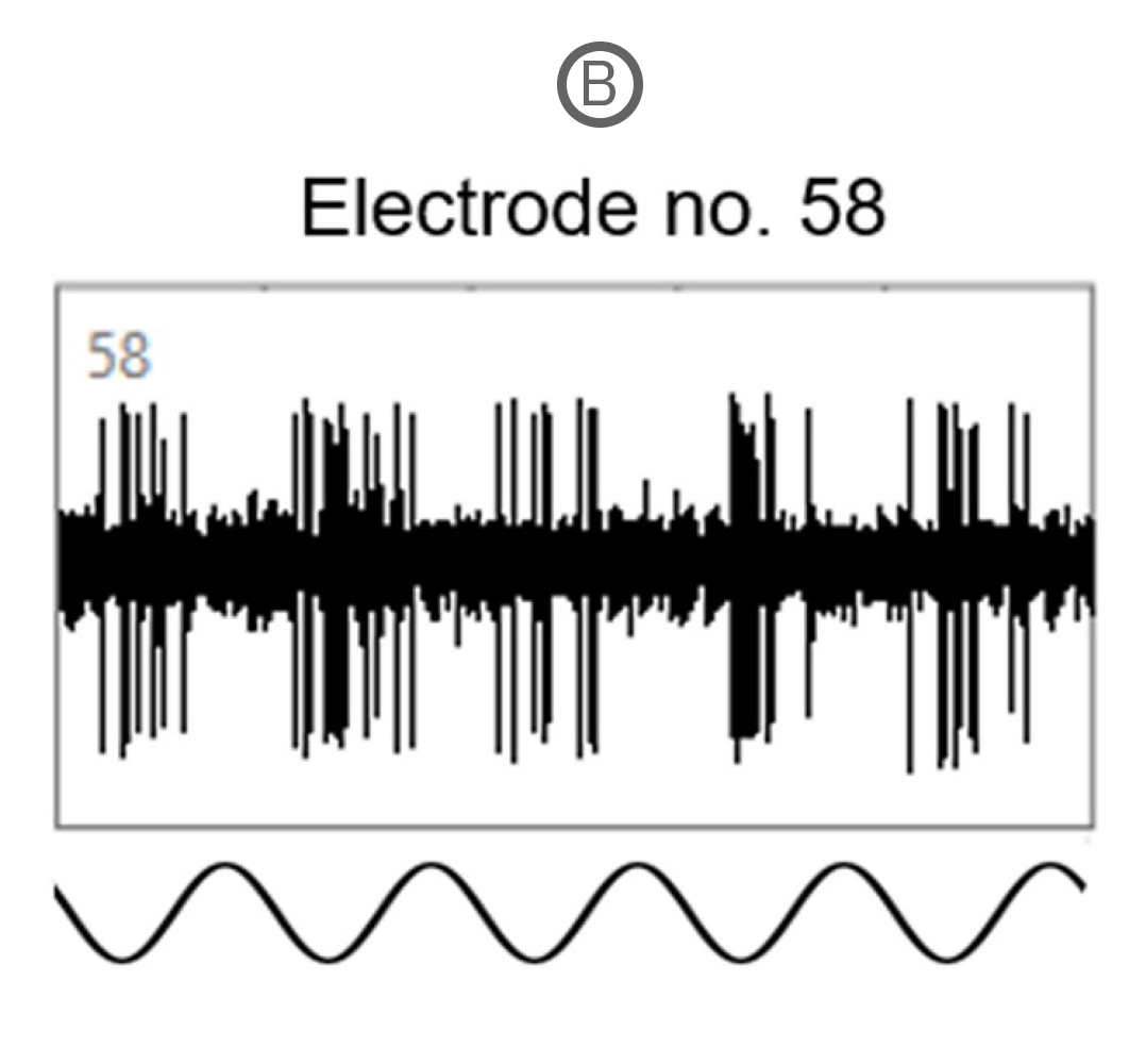 MEA recordings showing retinal ganglion cell responses to full-field flash and drifting sinusoidal grating stimulation