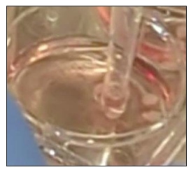 Neural organoid collection with a pipette before transfer to a microelectrode array plate for electrophysiology recording.