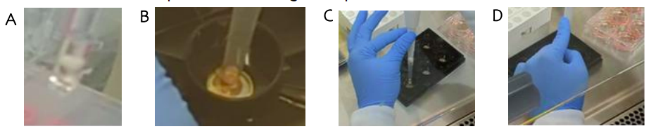 Neural organoid deposition into an MEA plate well using a pipette with stabilization techniques for accurate placement.