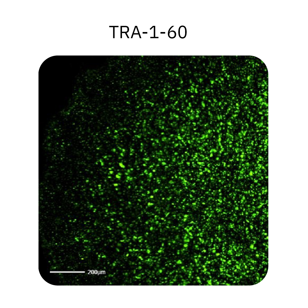 Green fluorescence image of human iPSC colonies stained with TRA-1-60 pluripotency marker on the Omni platform