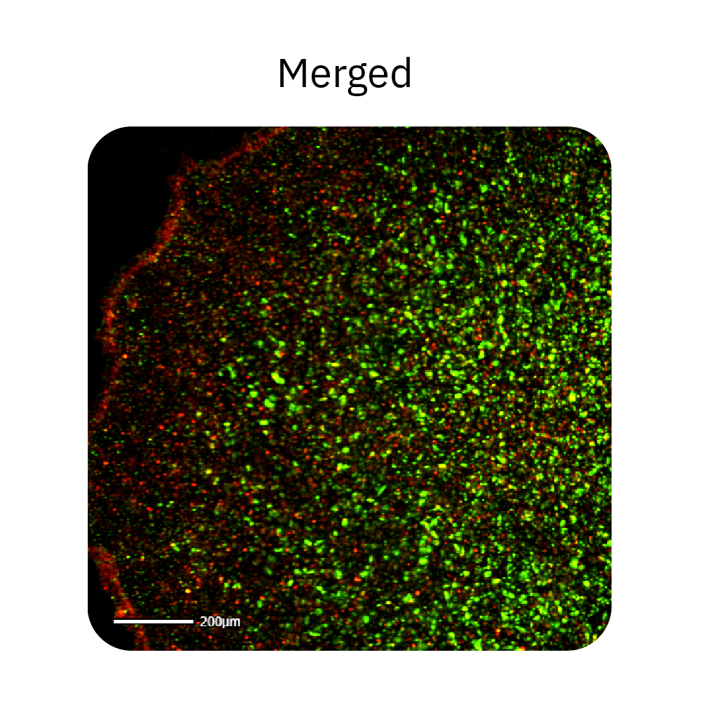 Merged fluorescence image showing TRA-1-60 and SSEA4-1 pluripotency marker expression in human iPSC colonies