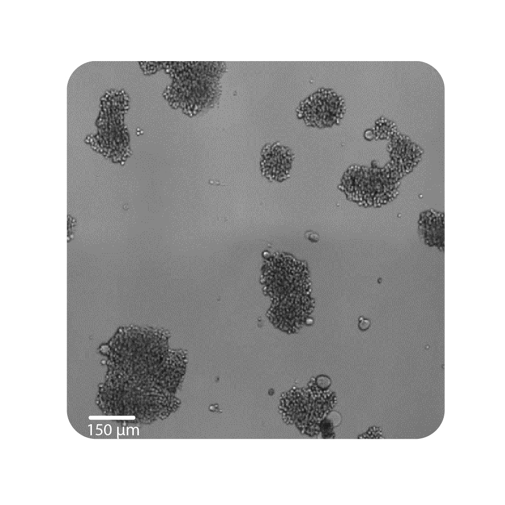 Live-cell imaging well view showing Jurkat T cell growth at different seeding densities for proliferation assay optimization