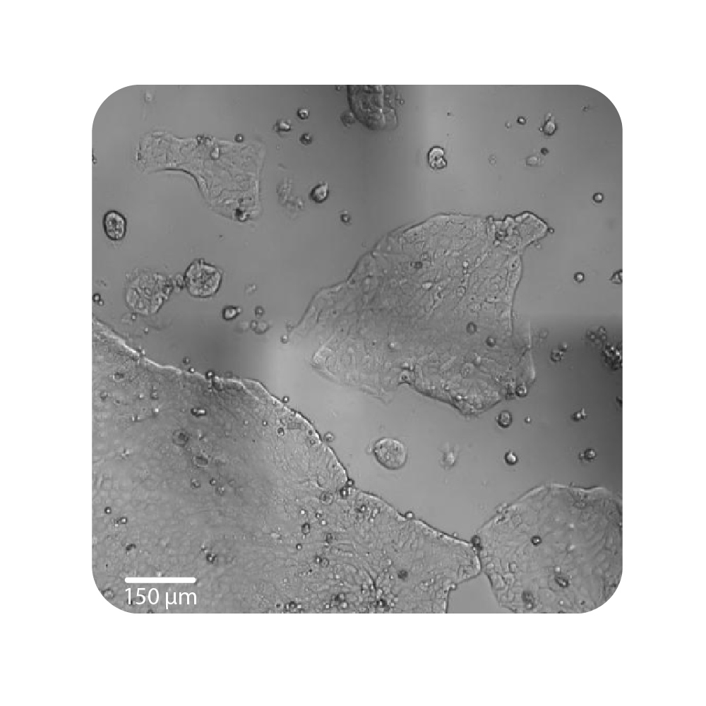 Live-cell imaging well view showing Calu-3 epithelial cell growth at different seeding densities for proliferation assay optimization