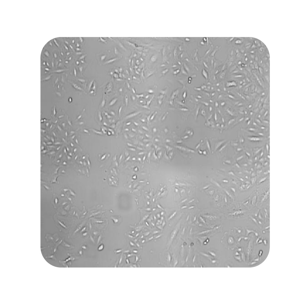Live-cell imaging well view showing A549 cancer cell growth at different seeding densities for proliferation assay optimization