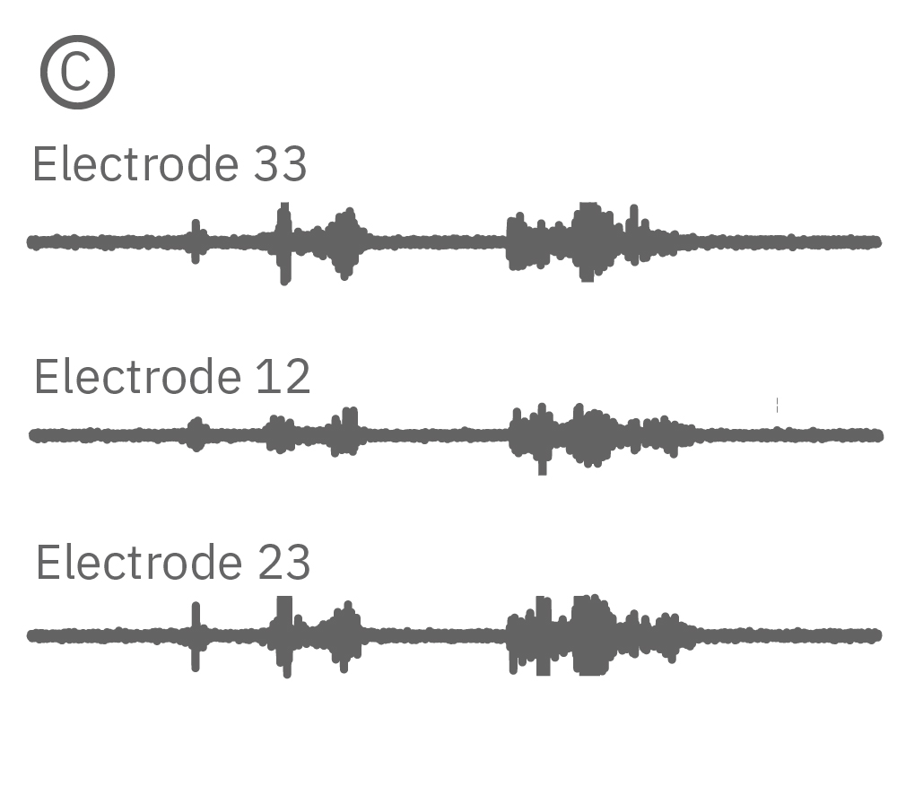 MEA electrophysiology traces recorded from three electrodes along a zebrafish spinal cord during live neural activity monitoring