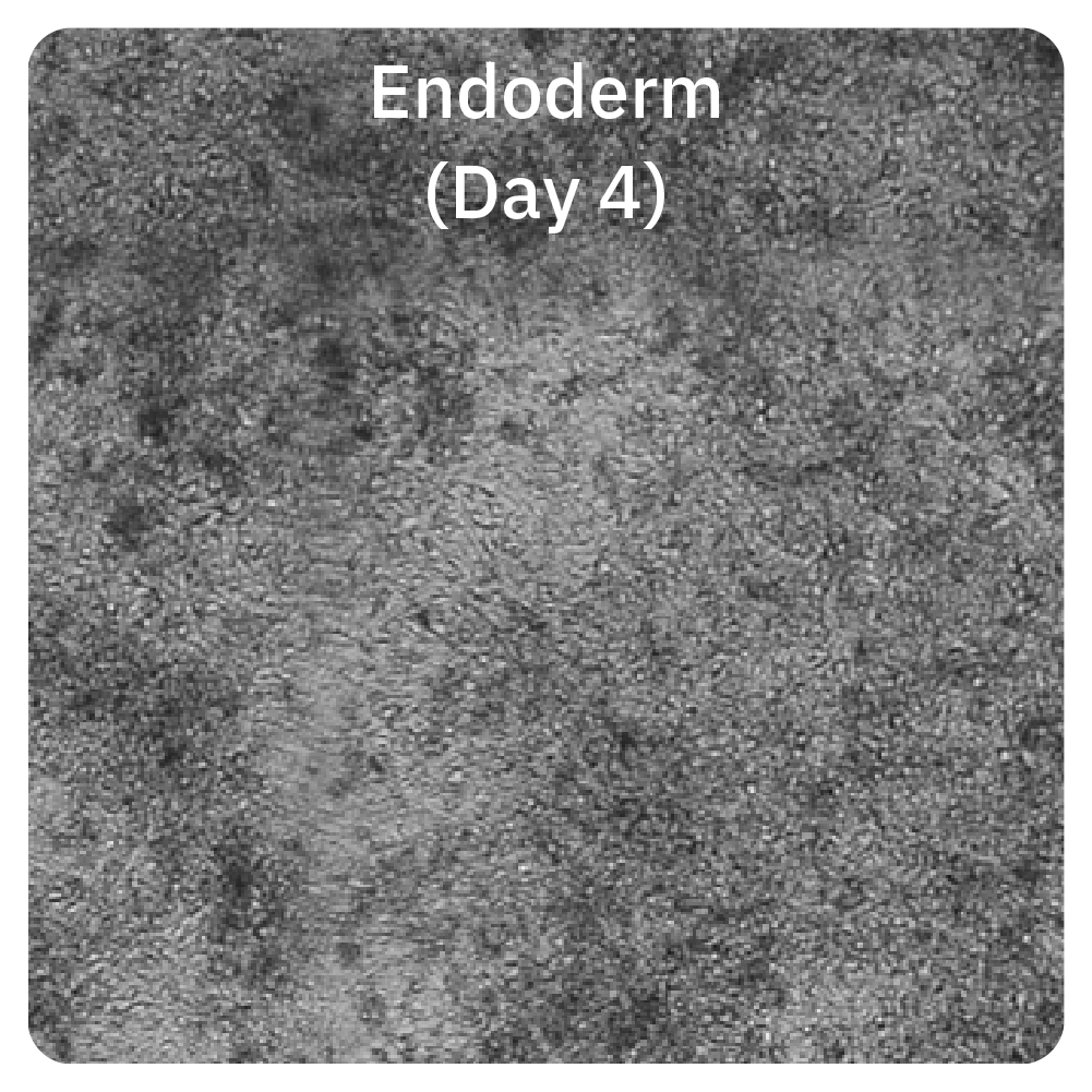 Omni live-cell imaging of endoderm cells on day 4 during iPSC-derived hepatic organoid differentiation