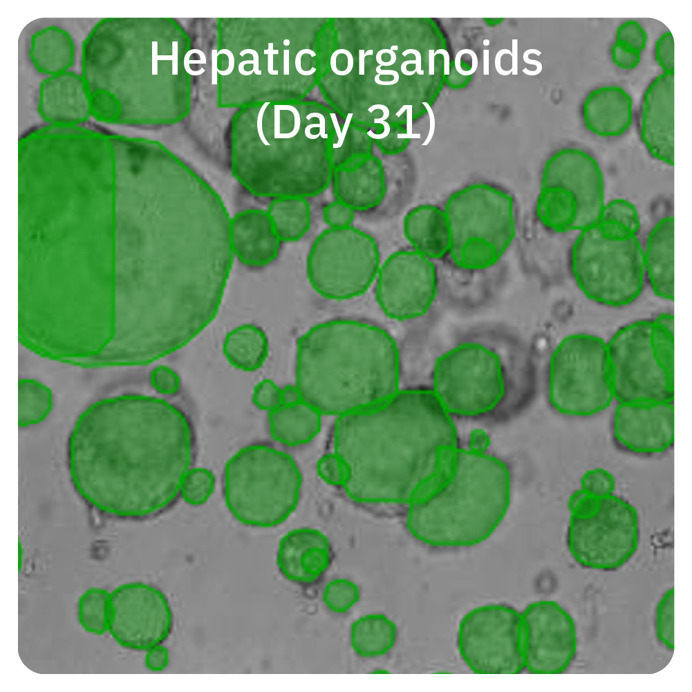 Omni live-cell imaging of hepatic organoids on day 31 for monitoring iPSC-derived organoid growth and development