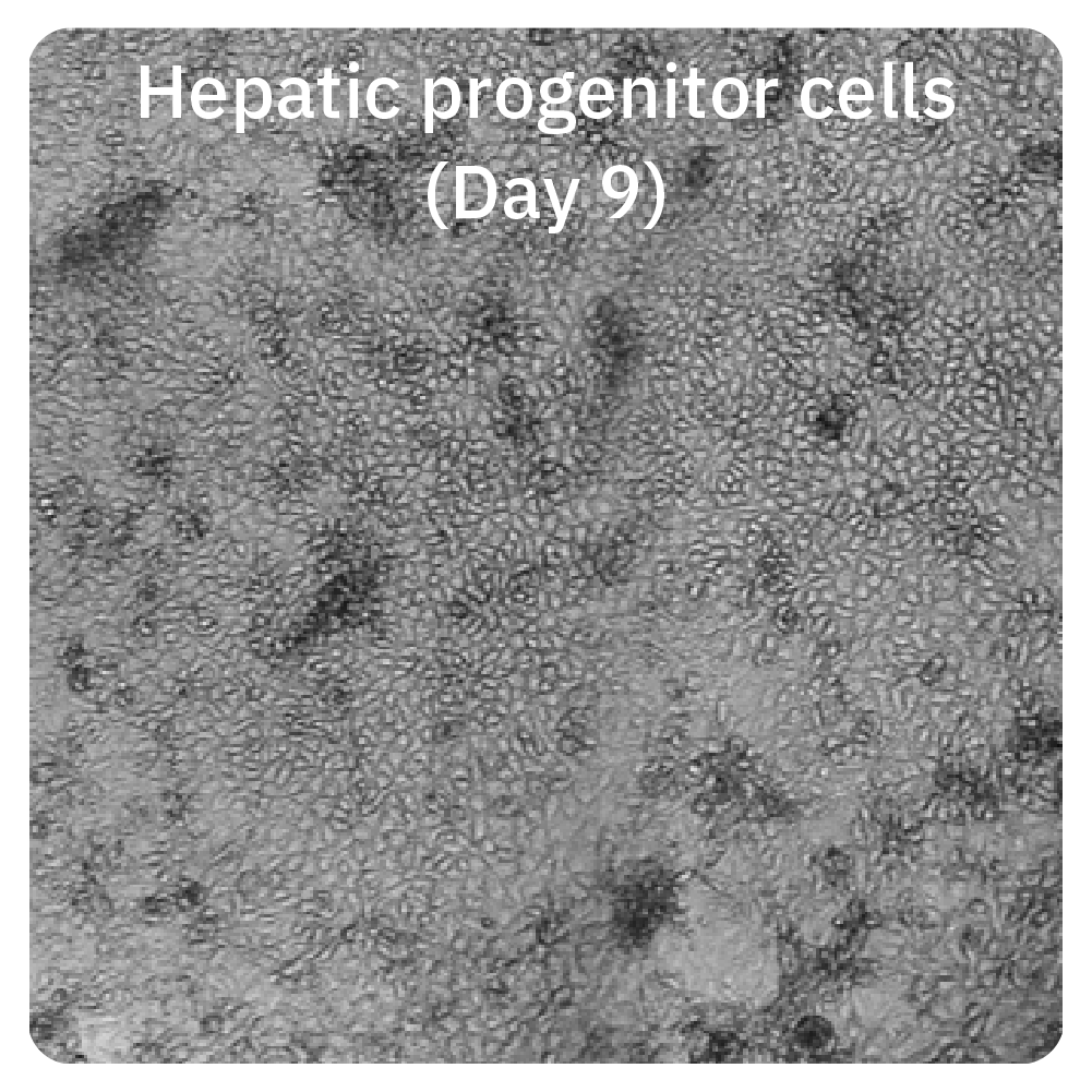 Omni live-cell imaging of hepatic progenitor cells on day 9 during iPSC-derived hepatic organoid development