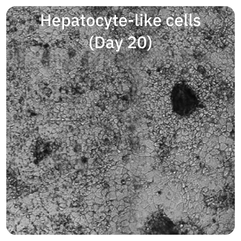 Omni live-cell imaging of hepatocyte-like cells on day 20 during hepatic organoid differentiation in vitro