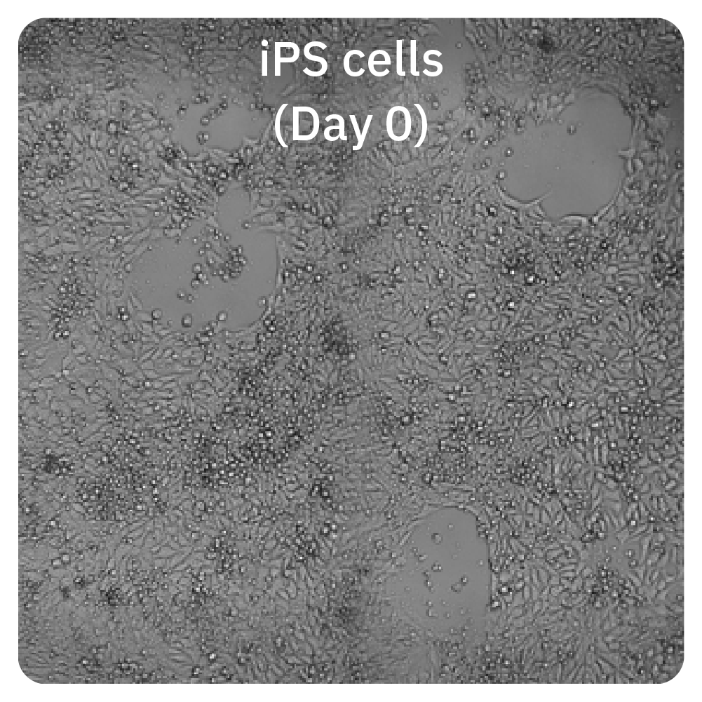 Omni live-cell imaging of iPS cells on day 0 during hepatic organoid differentiation research